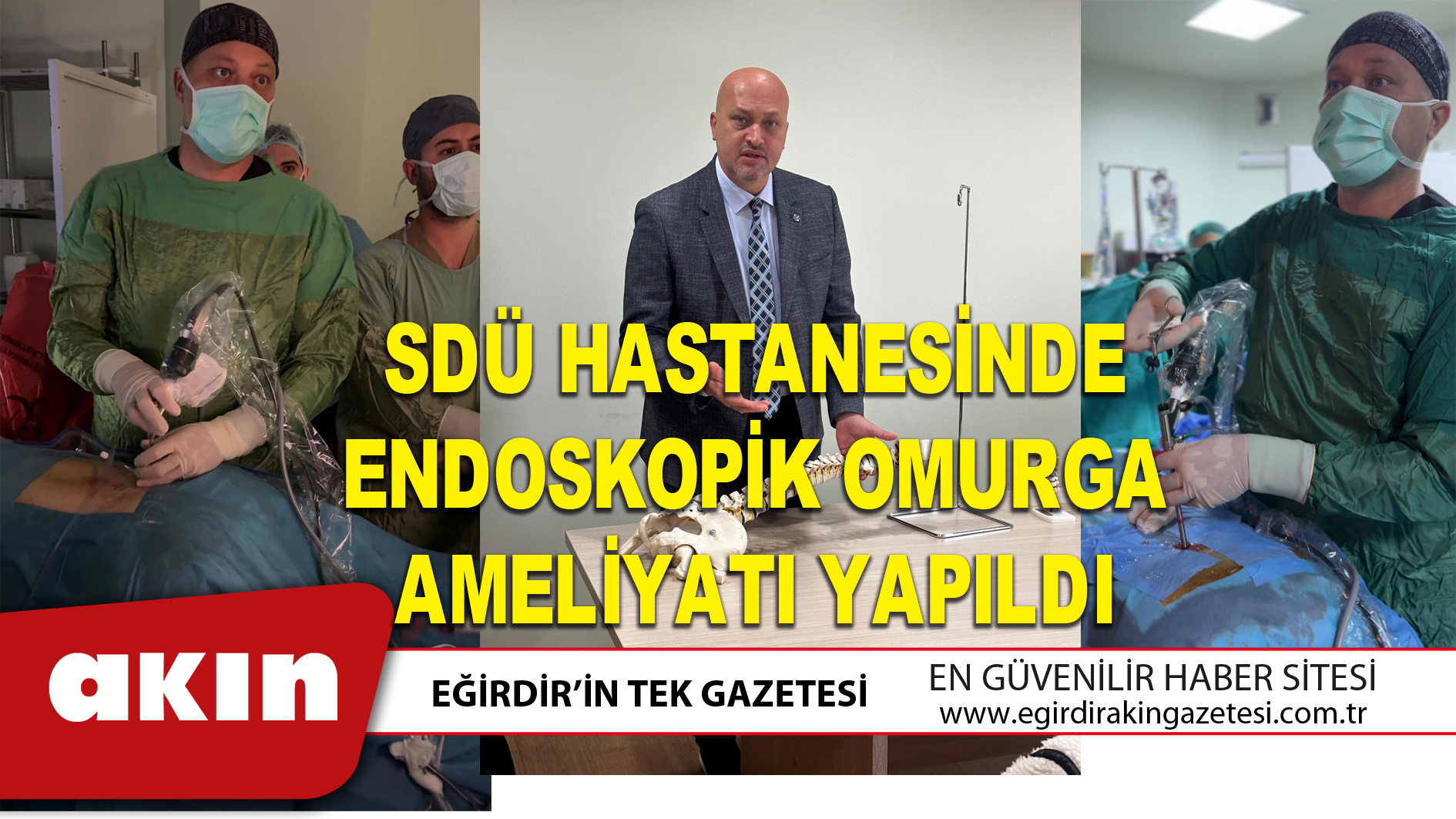 eğirdir haber,akın gazetesi,egirdir haberler,son dakika,SDÜ HASTANESİNDE ENDOSKOPİK OMURGA AMELİYATI YAPILDI