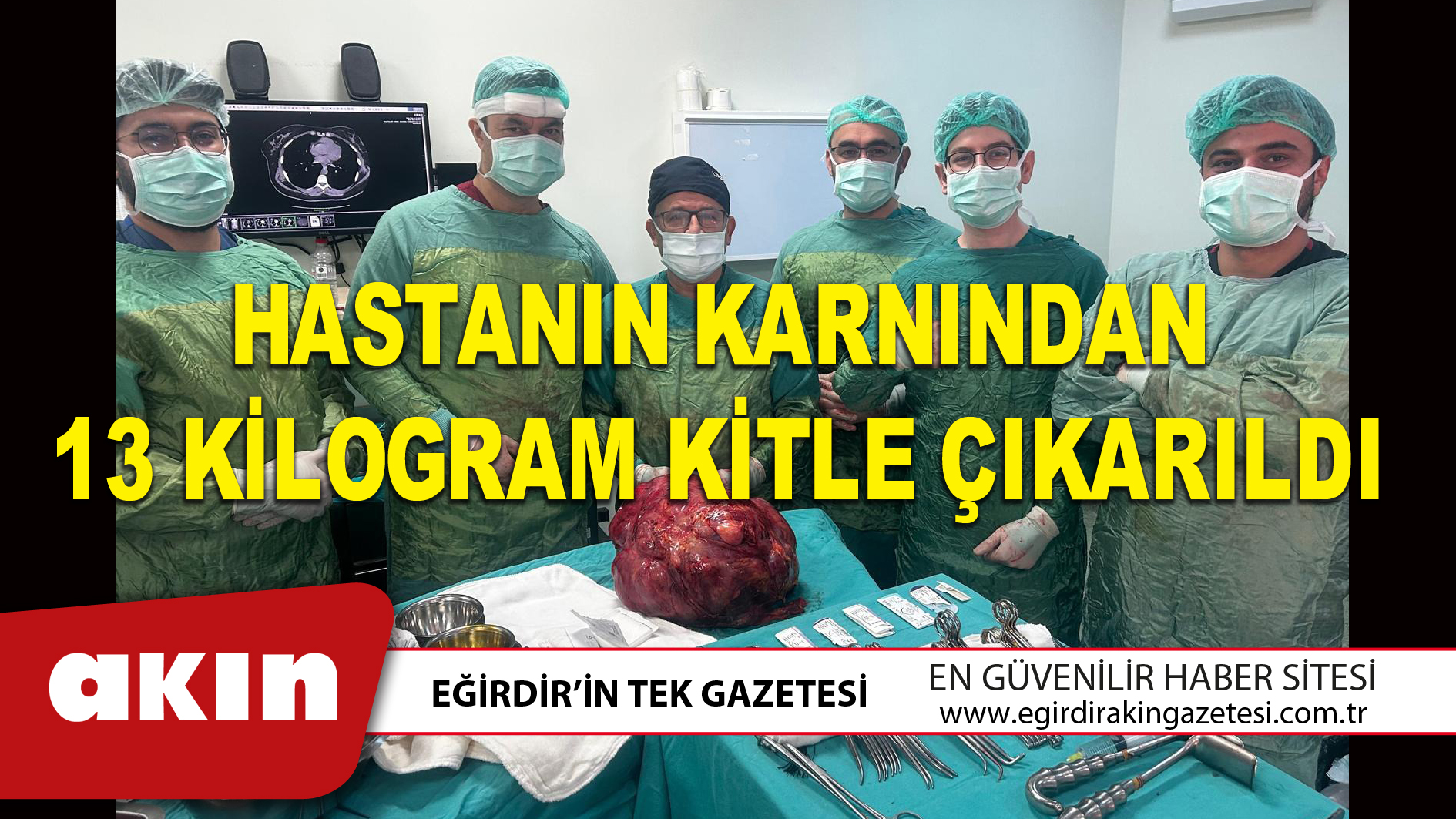 eğirdir haber,akın gazetesi,egirdir haberler,son dakika,HASTANIN KARNINDAN 13 KİLOGRAM KİTLE ÇIKARILDI